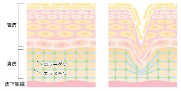 皮膚を内部から引き締め